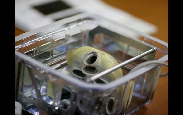 El corazón high-tech cuesta unos 220 mil dólares, tanto como el trasplante y gastos de operación. AP /