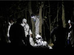 En la bolsa solo había partes de fémures. ARCHIVO /