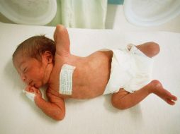 La niña se encuentra fuera de peligro en el hospital de la localidad argentina de San Martín. ARCHIVO /