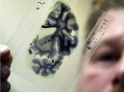 El cerebro de Maisha Najeeb quedó dañado de manera irreversible. ARCHIVO /