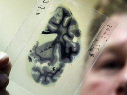Señalan que la capacidad de elasticidad del cerebro se va reduciendo con el paso de los años. ARCHIVO /