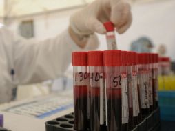 Cada mes, en el Antiguo Civil se llevan a cabo 300 pruebas de diagnóstico de diabetes. ARCHIVO /