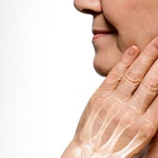 Osteoporosis, mal que afecta a mujeres en la menopausia