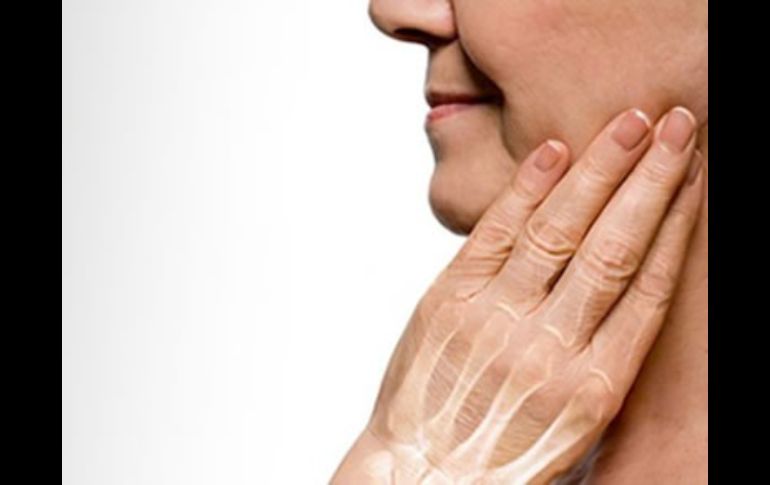 La reducción acelerada en la densidad de los huesos es una de las repercusiones no perceptibles durante la menopausia. ESPECIAL /