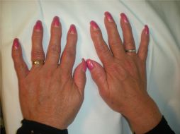 Los padecimientos se prensentan más severos en las mujeres que en los hombres. ARCHIVO /