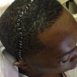 Aroldis Chapman comparte foto de sus puntadas