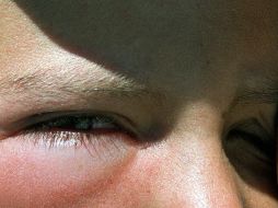 Además de los ojos, también las vías respiratorias pueden resultar afectadas. ARCHIVO /