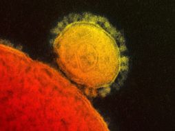 El virus provoca fiebre, tos, y dificultad para respirar. Casi la mitad de los infectados muere. AP /