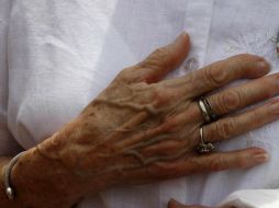 La arritmia es una enfermedad que persiste a lo largo de la vida, sin embargo los episodios pueden variar en cuanto a frecuencia. ARCHIVO /