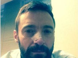 El actor agradece a sus doctores en su perfil de Instagram y recomienda a sus seguidores que se cuiden del sol. Foto: @thehughjackman. ESPECIAL /