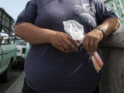 La cirugía es recomendada para pacientes con obesidad mórbida que desean bajar de peso. ARCHIVO /