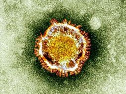 El virus MERS se originó en Arabia Saudita y se han presentado casos en Grecia,Egipto,Yemen, Estados Unidos entre otros países. ARCHIVO /