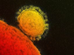 El MERS es un virus que ha dejado al menos 17 muertos, la mayoría en Arabia Saudita. ARCHIVO /