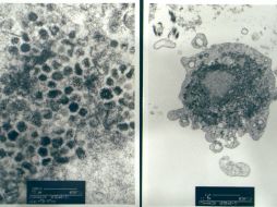 El SARS infectó a ocho mil personas en 2003 y causó la muerte a casi 800. ARCHIVO /