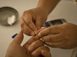 Los investigadores afirman que si es útil en animales, puede servir como terapia para los humanos. ARCHIVO /