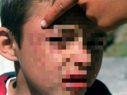 La mamá del pequeño dijo que el menor se cayó y por eso tenía los golpes, sin embargo los médicos no creyeron dicha versión. ARCHIVO /