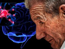 El complemento ideal de este trabajo de investigación sería contar con diagnósticos tempranos de la enfermedad. ESPECIAL /