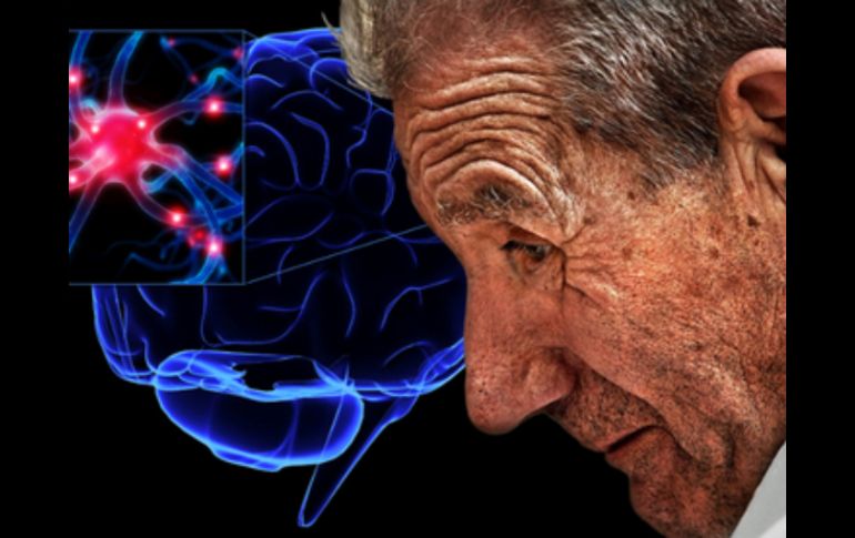 El complemento ideal de este trabajo de investigación sería contar con diagnósticos tempranos de la enfermedad. ESPECIAL /