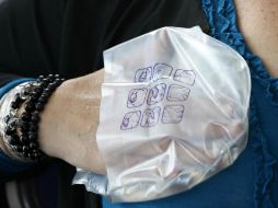 Oncotype DX analiza la actividad de un grupo específico de 21 genes del tumor de mama. ARCHIVO /