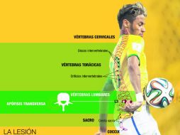 José Luiz Runco, médico del 'Scratch Du Oro', precisa que la lesión de Neymar es 'bastante común' en el futbol. EFE /