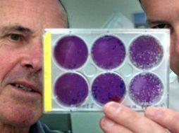 El último caso de esta enfermedad en Estados Unidos se remonta a 1949. ARCHIVO /