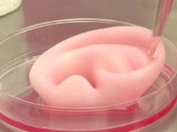 Las vaginas son fabricadas mediante el cultivo de tejidos a partir de muestras de células de las propias pacientes. ESPECIAL /