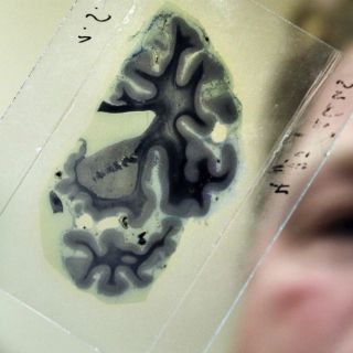 Desarrollan en EU tejido en 3D para estudiar heridas cerebrales