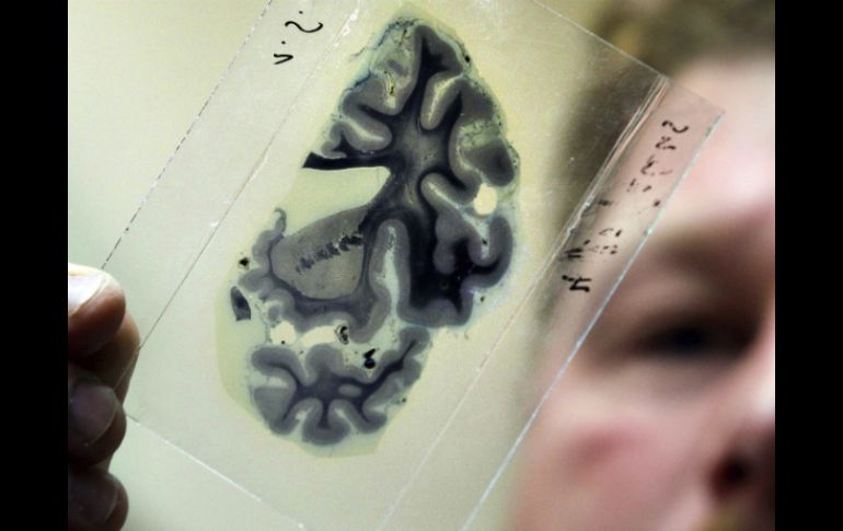 Se puede rastrear la reparación del daño y las implicaciones a largo plazo. ARCHIVO /