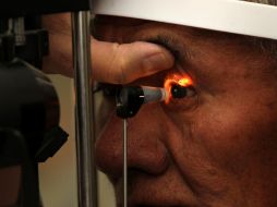 Algunos de los síntomas de inflamación en los párpados son ardor, ojo rojo, sensación de arenillas y comezón. ARCHIVO /