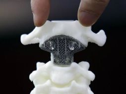 La impresión tiene la gran ventaja de que se pueden fabricar prótesis de forma y tamaño exactamente igual a la pieza original. ESPECIAL /