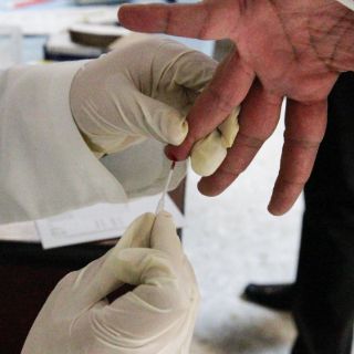 Alertan sobre factores que provocan enfermedades crónicas renales