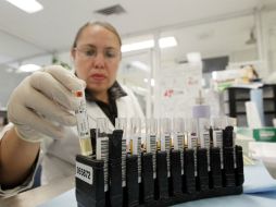 El tipo de sangre también está relacionado con otras condiciones vasculares como derrames cerebrales. EL INFORMADOR ARCHIVO.  /