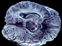 Durante mucho tiempo se creyó que sólo utilizábamos una décima parte de nuestro cerebro, siendo que utilizamos el cien. EFE ARCHIVO.  /