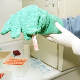 Células madre podrían ayudar a mejorar Alzheimer