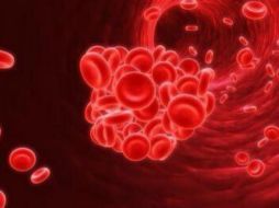 Un trombo transportado por el torrente sanguíneo puede terminar en Embolismo pulmonar o infarto. TWITTER  @iberovascular  /