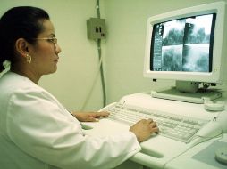 Durante 2013 fueron realizadas 52 mil mamografías. NTX / ARCHIVO