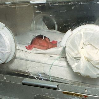 Médicos evitan pérdida de vista en bebés si detectan retinopatía