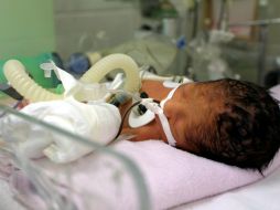 Trasladan a la recién nacida al área de urgencias del hospital Pediátrico de Iztapalapa, donde se le reporta fuera de peligro. EL INFORMADOR / ARCHIVO