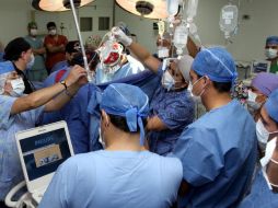 Tres personas han recibido este tipo de trasplante; dos se recuperan con normalidad y uno más continúa en cuidados intensivos. EFE / ARCHIVO