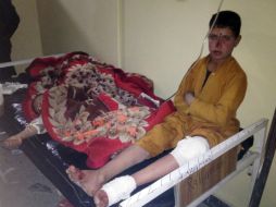 Niños afganos son atendidos en el hospital de Paktika después del ataque kamikaze. AP /