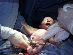 Tras pinzar y cortar el cordón umbilical luego del nacimiento, el ombligo debe manejarse con delicadeza y ser limpiado. EL INFORMADOR / ARCHIVO