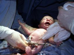 Un equipo del área de ginecología mantuvo hidratado y alimentado al feto a través de una sonda en el intestino materno. EL INFORMADOR / ARCHIVO