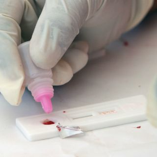 Acusan a médico de inocular voluntariamente el sida: Camboya