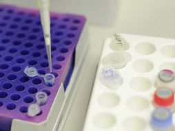 Los efectos secundarios de esta pastilla son mínimos. EFE / ARCHIVO