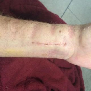 Drake Bell quedará impedido para tocar la guitarra