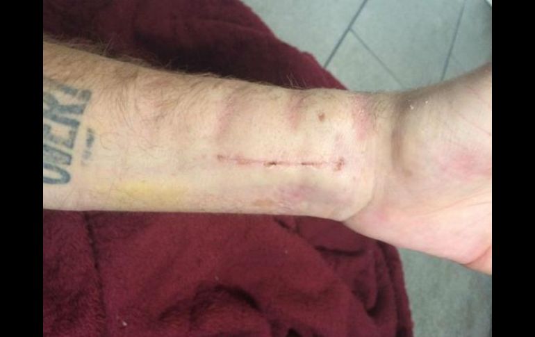 El cantante se mostró optimista sobre su fractura. TWITTER / @DrakeBell