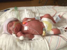 Los bebés se encuentran en buen estado pero necesitarán estar dos meses más en incubación. AP / Cortesía de Nicole Todman