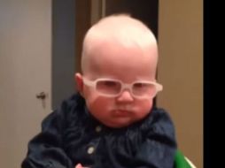 Louise tiene siete meses de edad y con ayuda de esos lentes, logró ver a su madre por primera vez YOUTUBE / Louise and Albinism