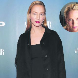 Desastres de la cirugía plástica