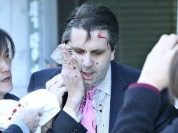 El ataque dejó una herida en el rostro de Lippert desde abajo del pómulo y se extendió en diagonal por la mejilla hacia su mandíbula. EFE /